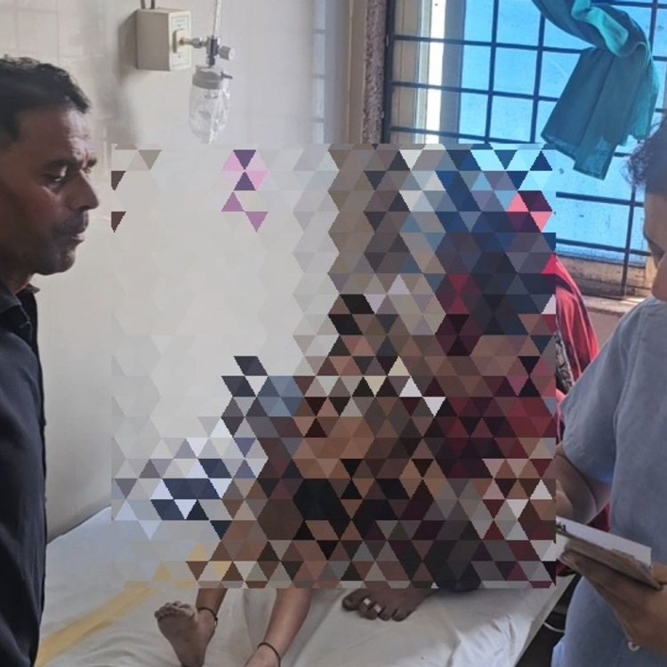 जलते कचरे के ढेर में गिरा 5 वर्षीय बच्चा:घर के बाहर खेलने के दौरान हुई घटना; मासूम का चेहरा जला, इंदौर रेफर