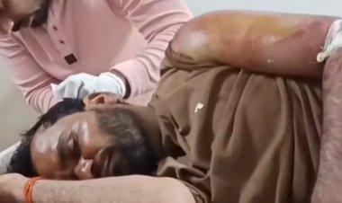 12 लोगों ने रॉड-डंडा और पाइप से पीटा, युवक बेहोश:बोलने की स्थिति में नहीं, गंभीर हालत में अस्पताल में भर्ती; भाई ने की शिकायत